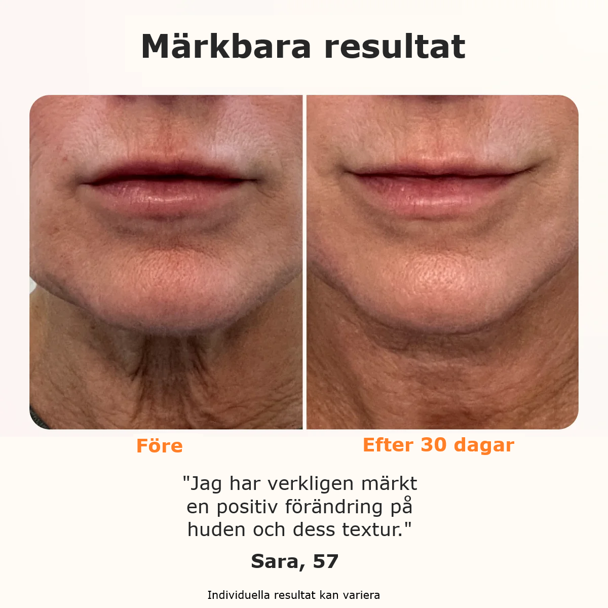 Dermaheal® Hudvårdsstav med Rödljusterapi